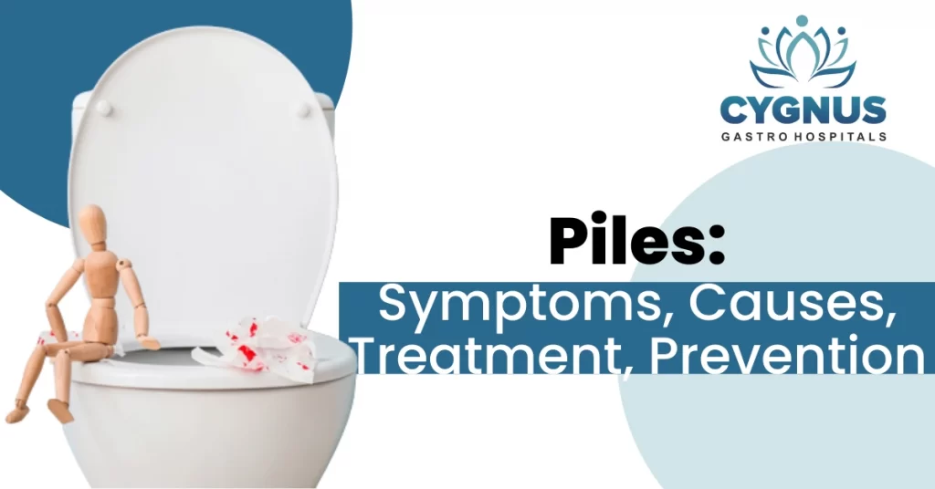 piles-causes-symptoms-treatment-prevention